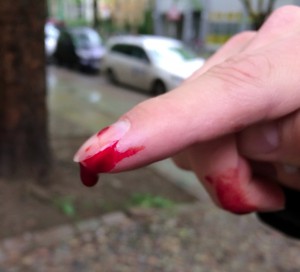 Cut Finger